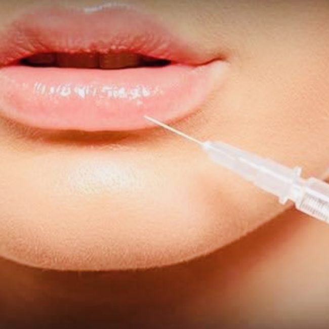 non-surgical rhinoplasty near london